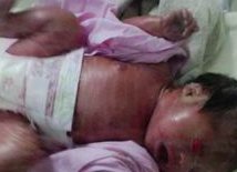 染色体易位在汕头市中心医院可以做三代试管吗？染色体平衡易位还能生健康的宝宝吗？